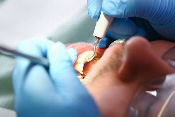 Best Cracked Tooth Emergency Dentist  in Pomeroy, WA