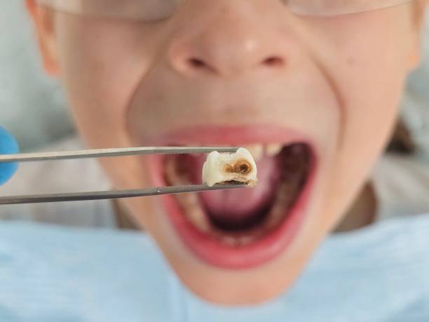 Best Urgent Dental Care  in Pomeroy, WA